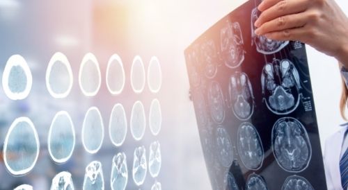 imagen de sarela centro de dia